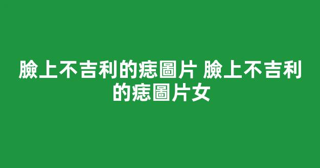 臉上不吉利的痣圖片 臉上不吉利的痣圖片女